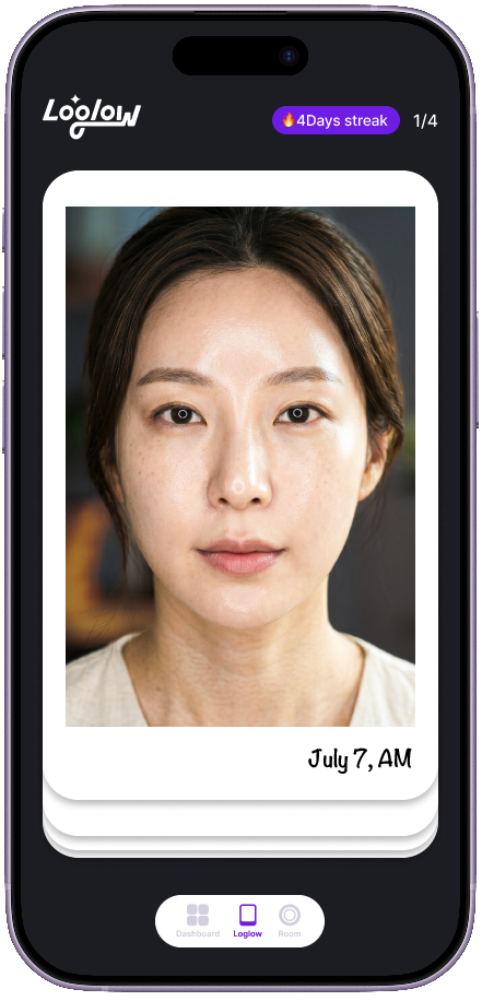 Loglow photo log screen