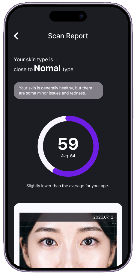 Loglow AI report screen
